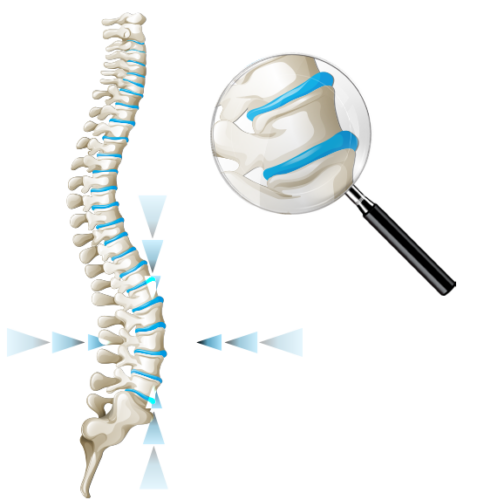 vertebra для межпозвоночных дисков